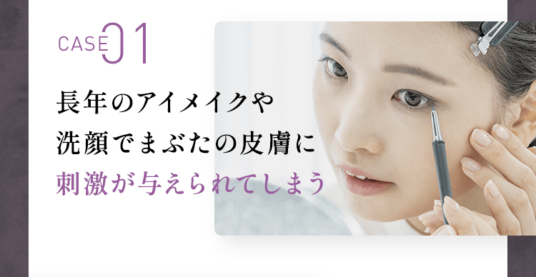 CASE01：長年のアイメイクや洗顔でまぶたの皮膚に刺激が与えられてしまう
